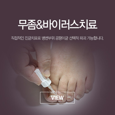 ����&���̷���ġ��